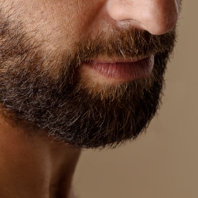 Recuperación de barba